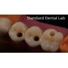 Buy cheap Professional Zirconia Dental Implant Crown Titanium CAD CAM Zirconia Crown China Dental Lab from wholesalers