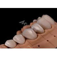 Buy cheap Strength Natural Esthetics Teeth Zirconia Crowns For Precise Fit Chip Resistance product