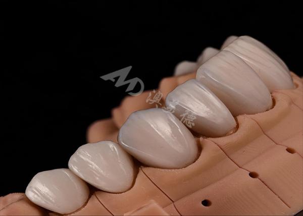 Buy cheap Strength Natural Esthetics Teeth Zirconia Crowns For Precise Fit Chip Resistance from wholesalers