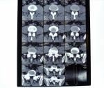 Diagnostic Laser X Ray Dry Film Medical For AGFA / Fuji Printer