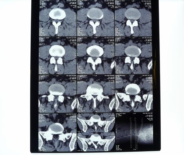 Buy cheap White PET AGFA Medical Dry Film from wholesalers