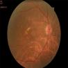 Buy cheap Autofocus Ultra Wide Field Fundus Camera 3.3mm Non Contact from wholesalers