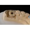 Buy cheap 3.75mm Silver Titanium Screw Dental Implant Single Tooth Replacement Implant from wholesalers