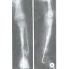 Buy cheap Waterproof Dry Medical X Ray Films Konida Glossy For AGFA / Fuji from wholesalers