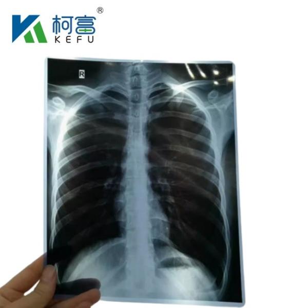 Buy cheap 8x10 Inch 14x17 Inch Blue Medical X Ray Film Substitute Fuji Medical Dry Film For Clinic And Hospitals from wholesalers