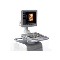 Buy cheap 4D Color Doppler Trolley Portable Ultrasound Scanner Fast Light Quiet Smart product