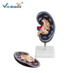 Medical Science Human Body Anatomy Model Human Kidney Model 20x10x7CM