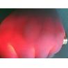 Buy cheap No Radiation Strong Red Light Infared Vein Finder With Mobile Rechargeable Battery from wholesalers
