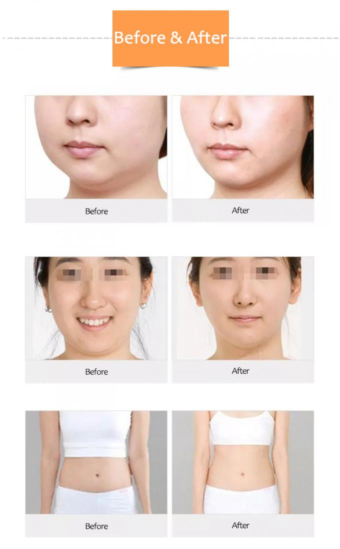 Radio Frequency Skin Tightening Machine For Skin Laxity Treatment Beauty Salon Machine 4