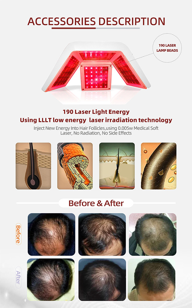 5 In 1 Laser Hair Growth Machine 650nm Diode Therapy Beauty Salon Equipment