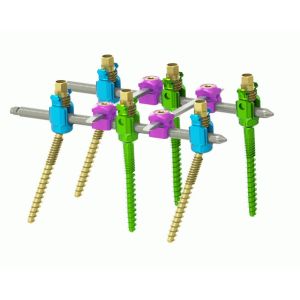 Buy cheap Minimally Invasive Internal Spinal Fixation System product
