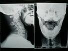 Konida Medical Dry Imaging Film Digital X-ray For Fuji / Agfa Printers