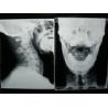 Buy cheap X Ray Medical Imaging Film from wholesalers