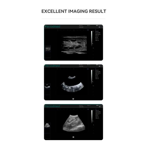 Yonker Factory Price Veterinary Ultrasound Machine Veterinary Ultrasound Portable Xuzhou Veterinary Ultrasound