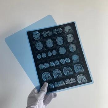 Buy cheap Medical X Ray Dry Film Medical X Ray Inkjet Film With Clear Image Quality from wholesalers