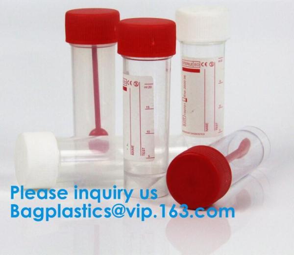 Buy cheap Disposable Urine Specimen Cup/Urine Sample Containers/Urine Collection Cup,Sterile Disposable Hospital Sample 60ml 100 from wholesalers