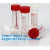 Buy cheap Disposable Urine Specimen Cup/Urine Sample Containers/Urine Collection Cup,Sterile Disposable Hospital Sample 60ml 100 from wholesalers