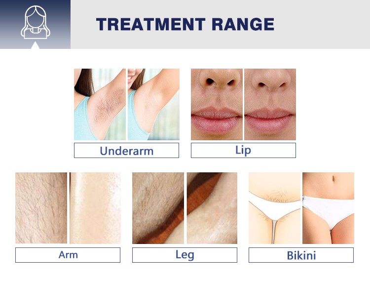 Factory Price 60 million times shot Perfect Cooling System 808nm Diode Laser Hair Removal Machine