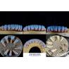 Buy cheap High Biocompatibility Feldspathic Ceramic Veneer Glossy For Dental Restorations from wholesalers