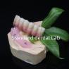 Buy cheap Screwed All On 6 Full Zirconia Bridge Dental High Accuracy Over Ti Base from wholesalers