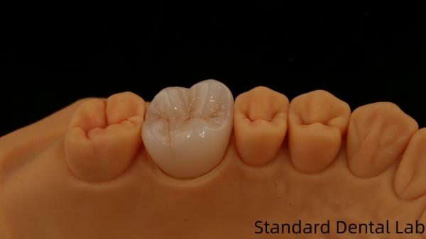 Buy cheap Noritake Porcelain Full Contour Zirconia Crown Customized Vita Shade for Esthetic Digital Dental Restoration by Dental Lab from wholesalers