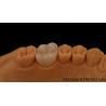 Buy cheap Noritake Porcelain Full Contour Zirconia Crown Customized Vita Shade for Esthetic Digital Dental Restoration by Dental Lab from wholesalers