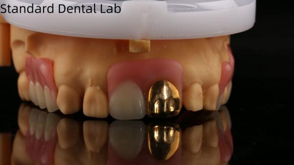 Buy cheap Full Acrylic Dentures With Yellow Gold Teeth/Dental Temporary Acrylic Denture Ivoclar Professional FDA Approved from wholesalers