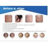 Buy cheap most advanced 30w power USA Coherent laser vertical fractional co2 laser with vaginal tightening from wholesalers