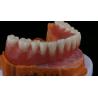 Buy cheap Ivoclar Digital Dental Implant Bar Denture with Attachments Full Acrylic Denture Titanium Implant Supported Dentures from wholesalers