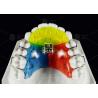 Buy cheap Stainless Steel Acrylic Screw Expander Orthodontic Treatment Removable from wholesalers
