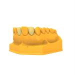 80C Hot Deformation Resistant Permanent Crown Bridge Resin for Longevity