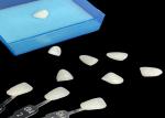 Porcelain Emax Veneer Translucency Bonding For Precise Esthetic Restorations