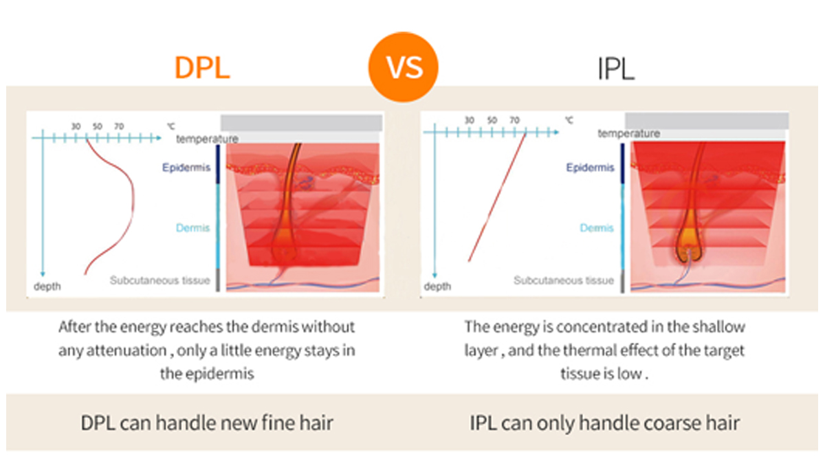 DPL IPL OPT E-Light Permanent Laser Hair Removal Skin Rejuvenation Beauty Machine