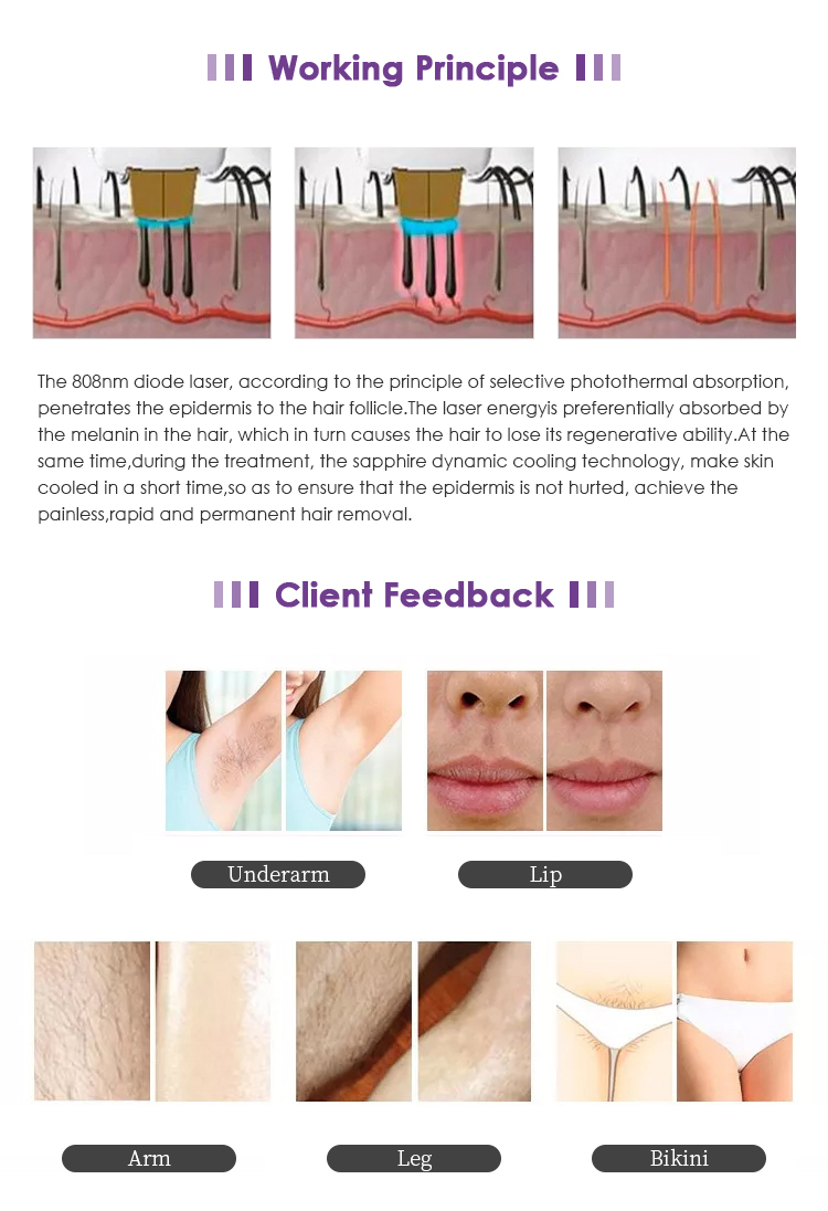Professional Commercial 808nm Diode Laser Painless Hair Removal Device Machine