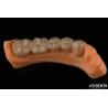 Buy cheap Precision Dental Restorations Full Zirconia High Flexural Strength Natural Color from wholesalers