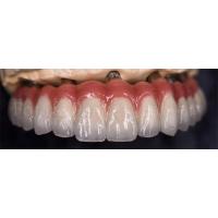 Buy cheap Staining Resistance Dental Lab Crowns For Various Tooth Replacements product