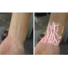 Buy cheap Medical Professional Infrared Vein Viewer Transilluminator Find Veins For Phlebotomy from wholesalers