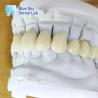 Buy cheap Translucent Layered Zirconia Crown Dental Restoration Multilayer Zirconia Crown from wholesalers