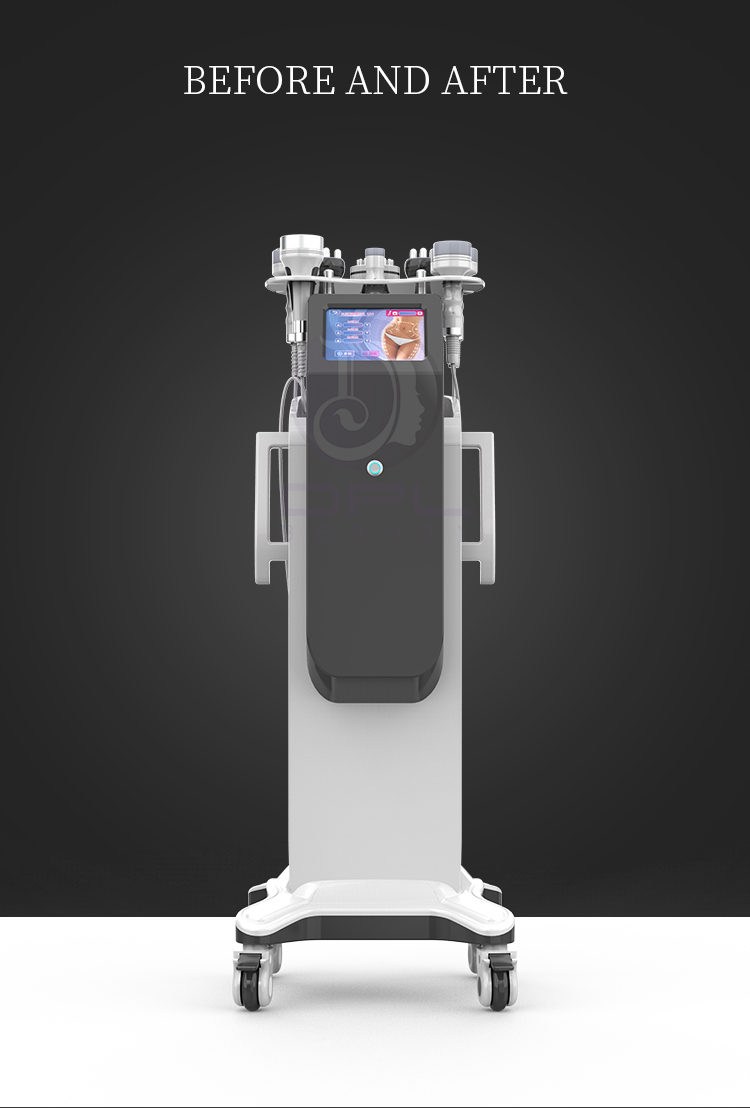 Lipo 8 In 1 80k Ultrasonic Vacuum Cavitation Machine Body Slimming Professional