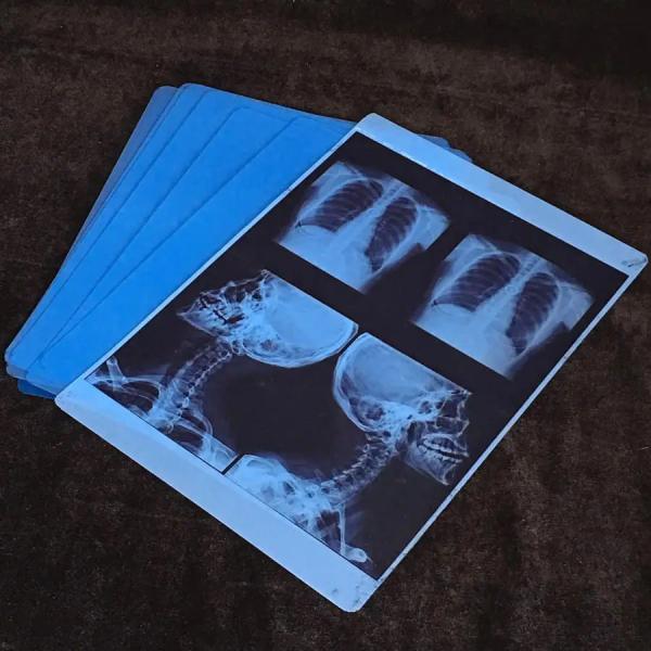 Fuji Printer Dry Imaging Film Inkjet Film with Maximum Transmission Density of