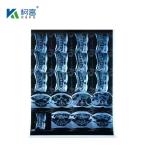 Inkjet Medical X-RAY Blue Film 210micron CT DR Film A4 8x10 Sheet Or Roll For