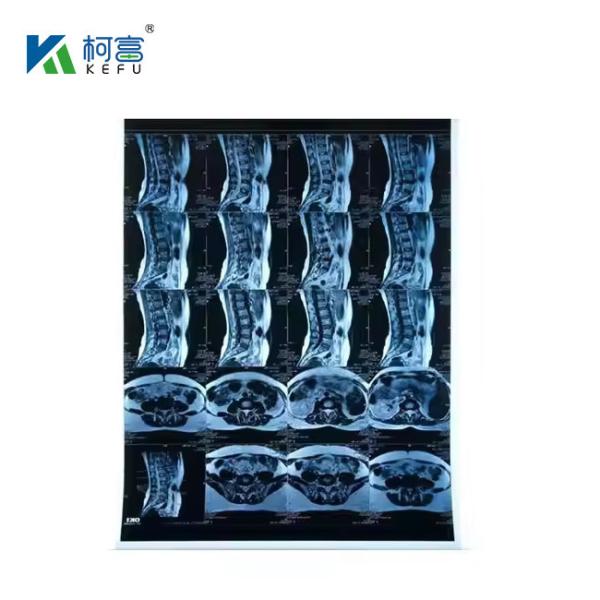 Inkjet Medical X-RAY Blue Film 210micron CT DR Film A4 8x10 Sheet Or Roll For