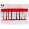 Buy cheap 10ml Blood Specimen Tubes Inactivated Virus Preservation from wholesalers