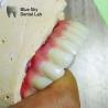 Buy cheap Nature Surface Universal Compatible Multiple Choices Implant operation cases for Steam Sterilization from wholesalers