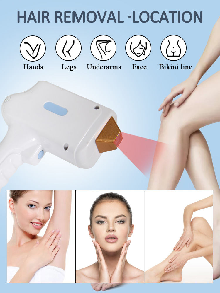 Portable 808nm Diode Laser Hair Removal Machine For Home hair removing laser machine lady hair removal machine