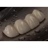 Buy cheap Customizable Ceramic Crown Bridge For Missing Tooth Comfortable Perfect Fit from wholesalers