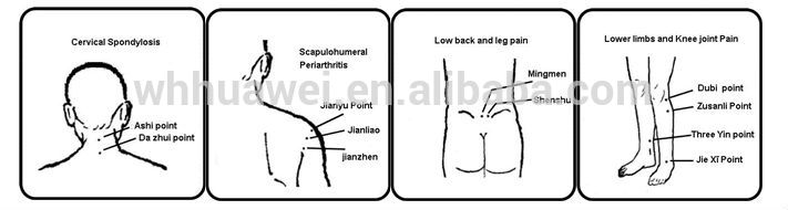 arthritis natural back pain relief