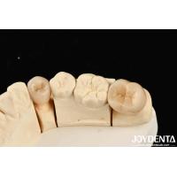 Buy cheap Excellent Biocompatibility Full Zirconia With High Resistance To Corrosion And product
