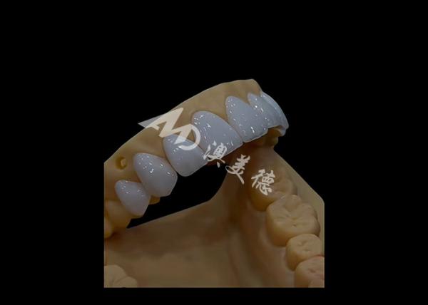 Prosthetic Dentistry Zirconia Dental Crown Precise Fit Aesthetics For full arch