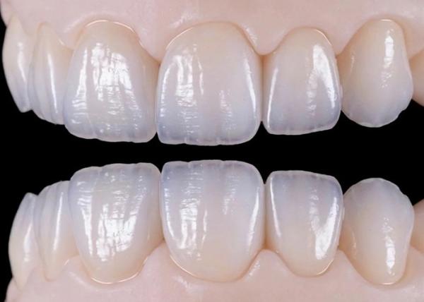 Buy cheap Natural Wear Resistant Ceramic Dental Crown Bridge For Lifelike Restoration from wholesalers